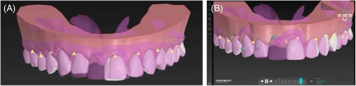 Figure 14