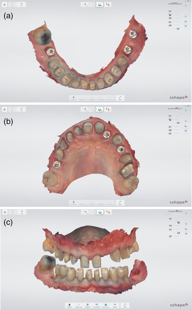 Figure 10