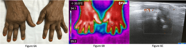 Figure 6