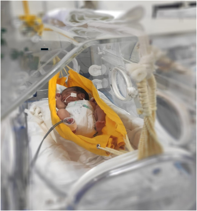 Figure 2