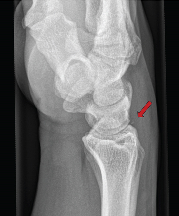 Figure 4