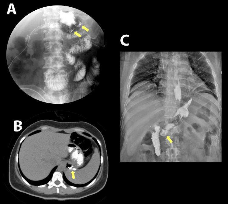Figure 4