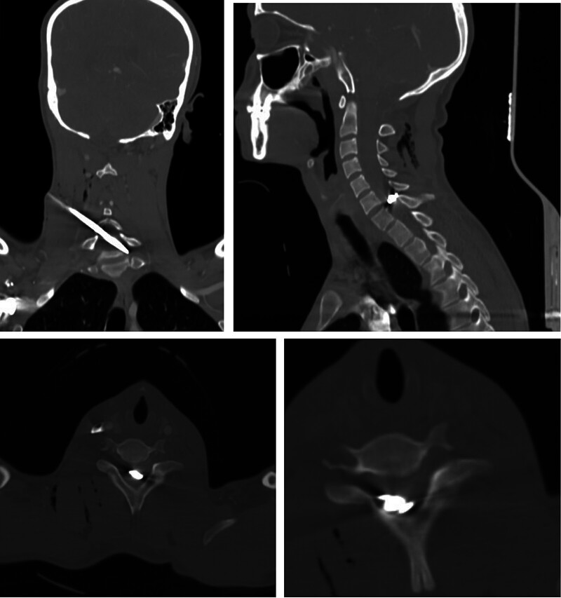 Figure 2