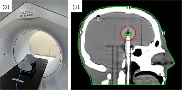 FIGURE 2
