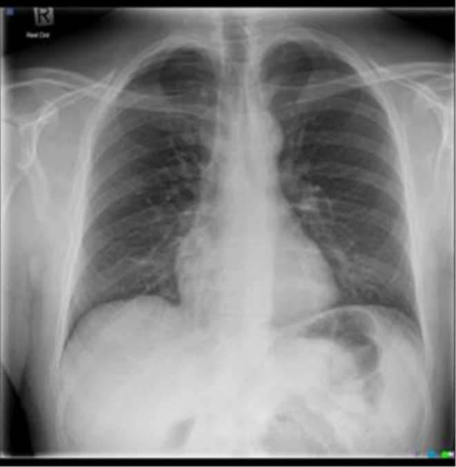 FIGURE 1