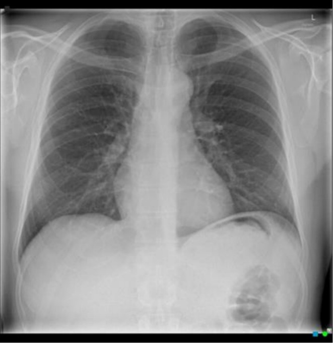 FIGURE 4