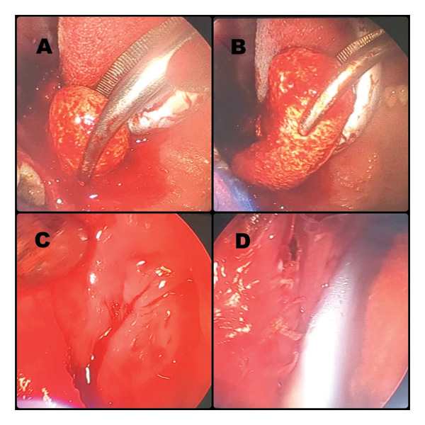 FIGURE 3