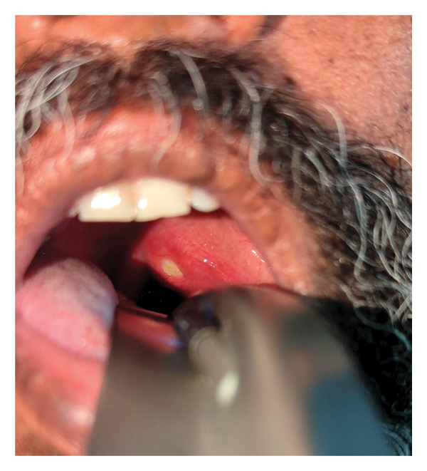FIGURE 1