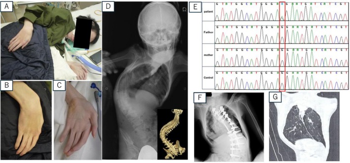 FIGURE 1