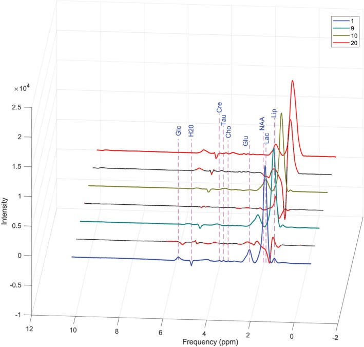 FIGURE 4