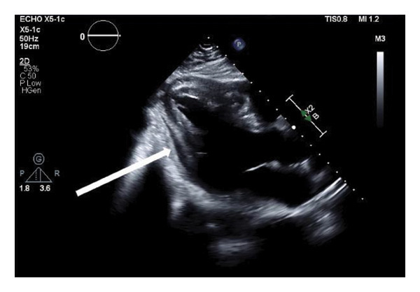 FIGURE 2
