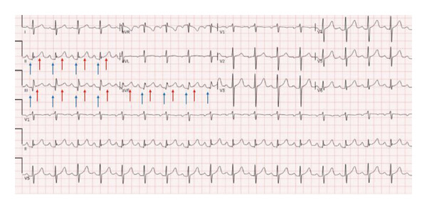 FIGURE 1