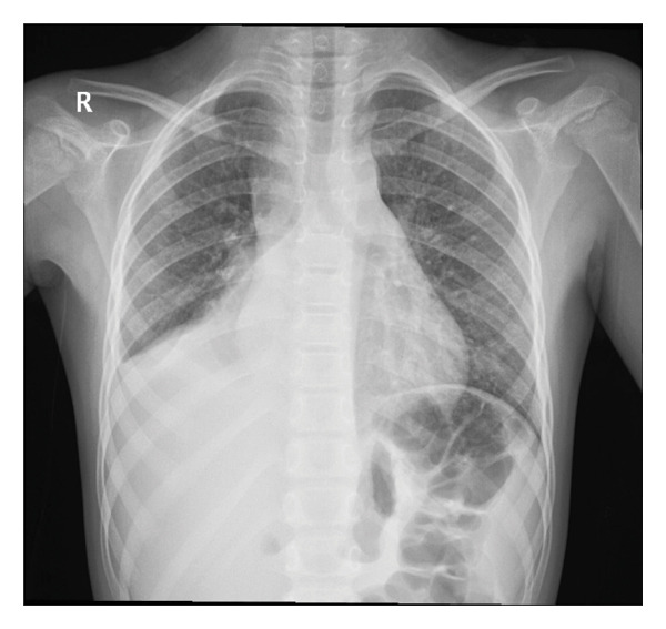 FIGURE 1