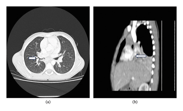 FIGURE 2