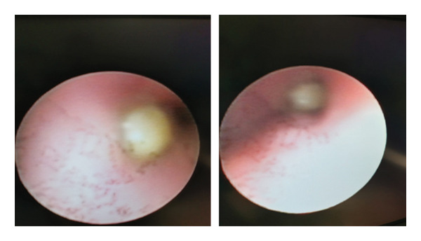 FIGURE 3