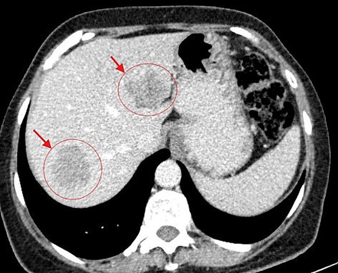 FIGURE 1