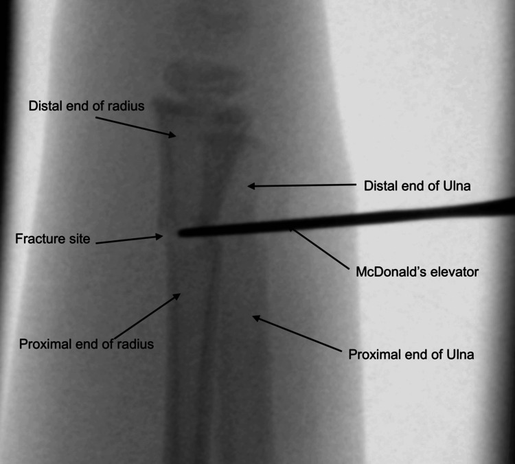 Figure 9