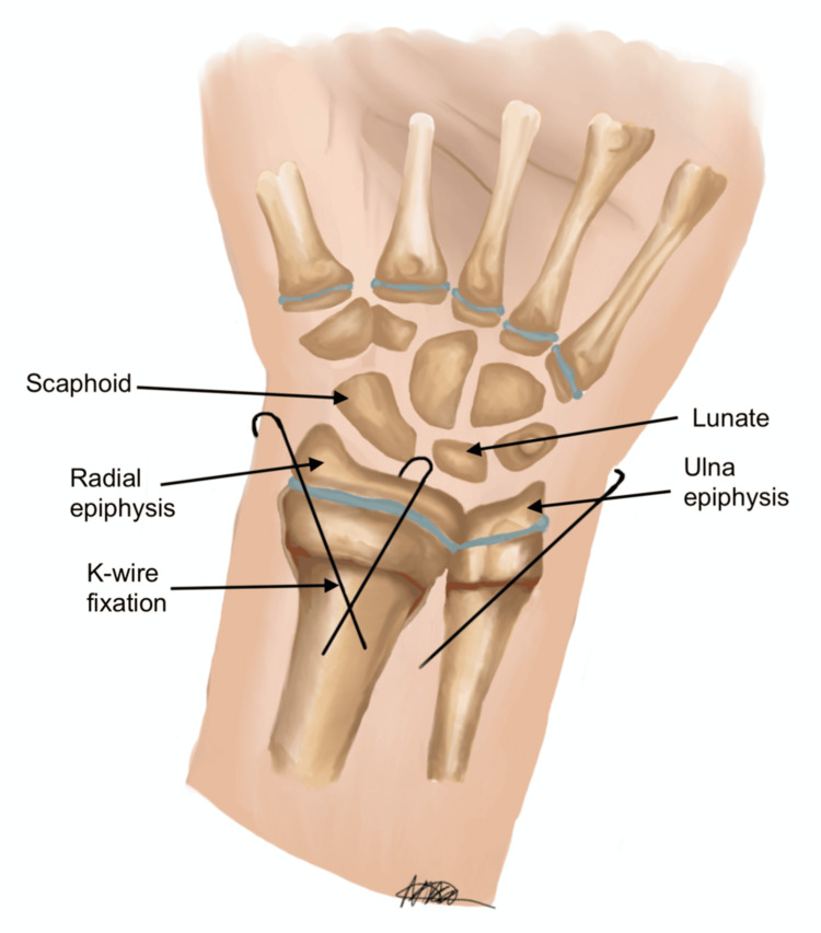 Figure 10
