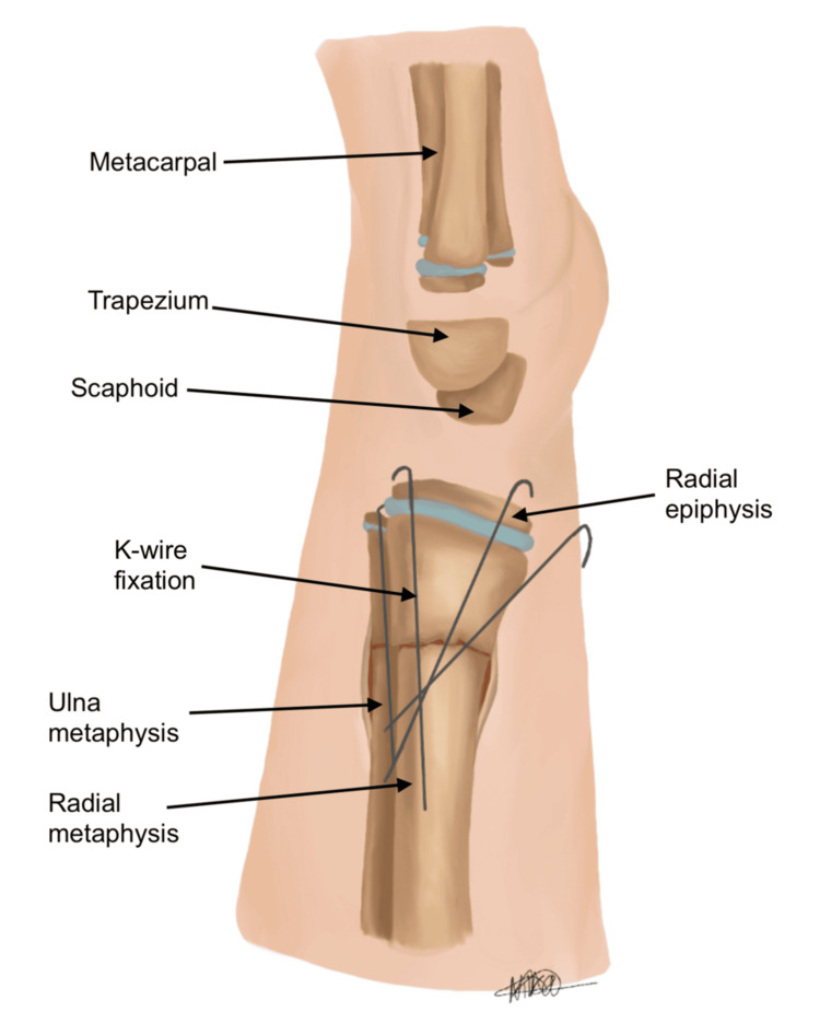 Figure 11
