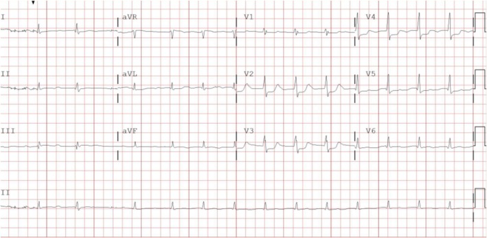 FIGURE 1