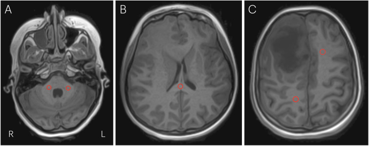Fig 4
