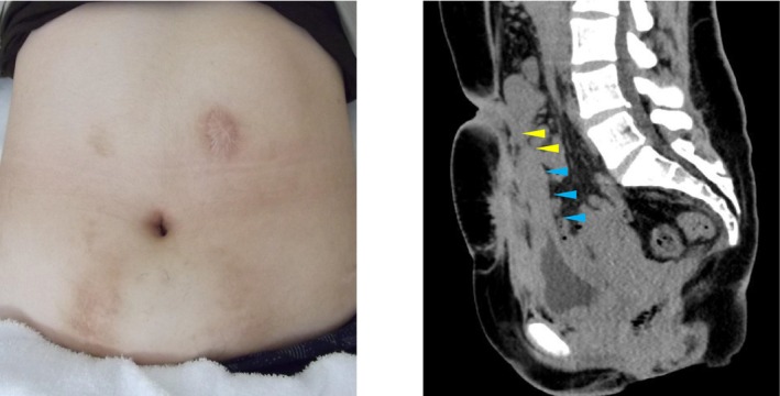 FIGURE 4