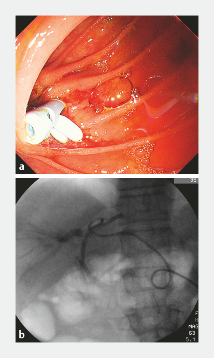 Fig. 5
