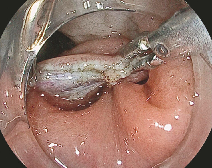 Fig. 3