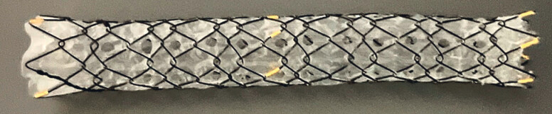 Fig. 1