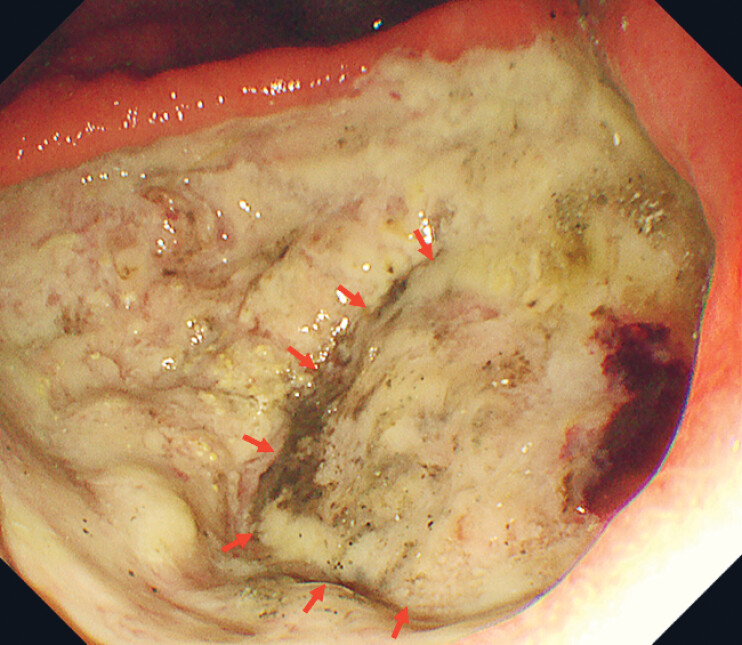 Fig. 2