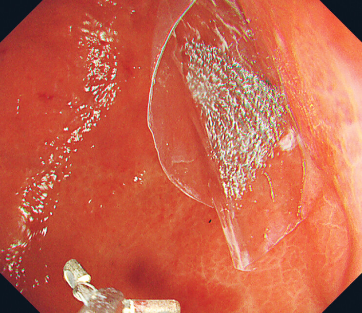 Fig. 4
