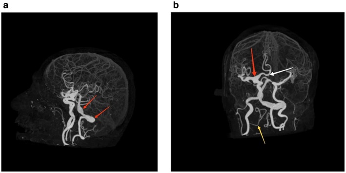 FIGURE 3