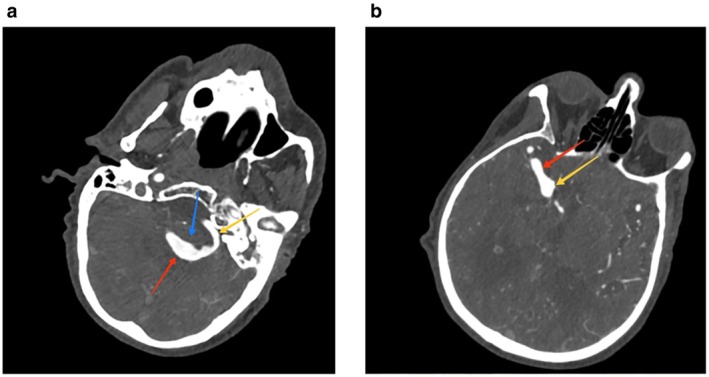 FIGURE 2
