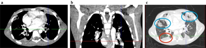 FIGURE 2