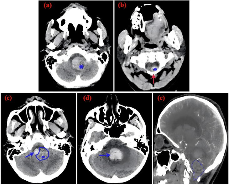 Figure 1