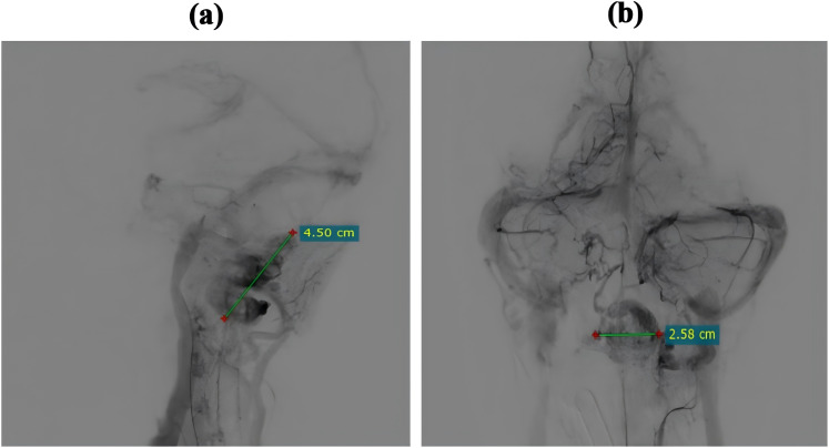 Figure 2