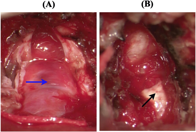 Figure 3