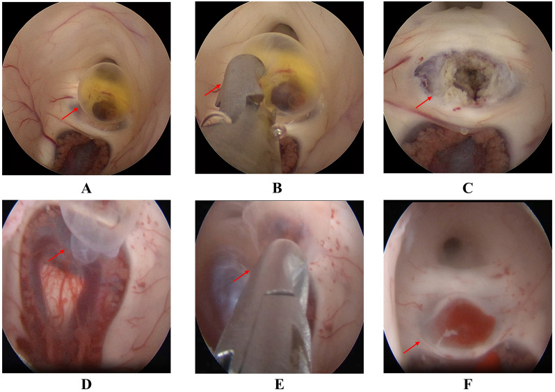 Figure 2