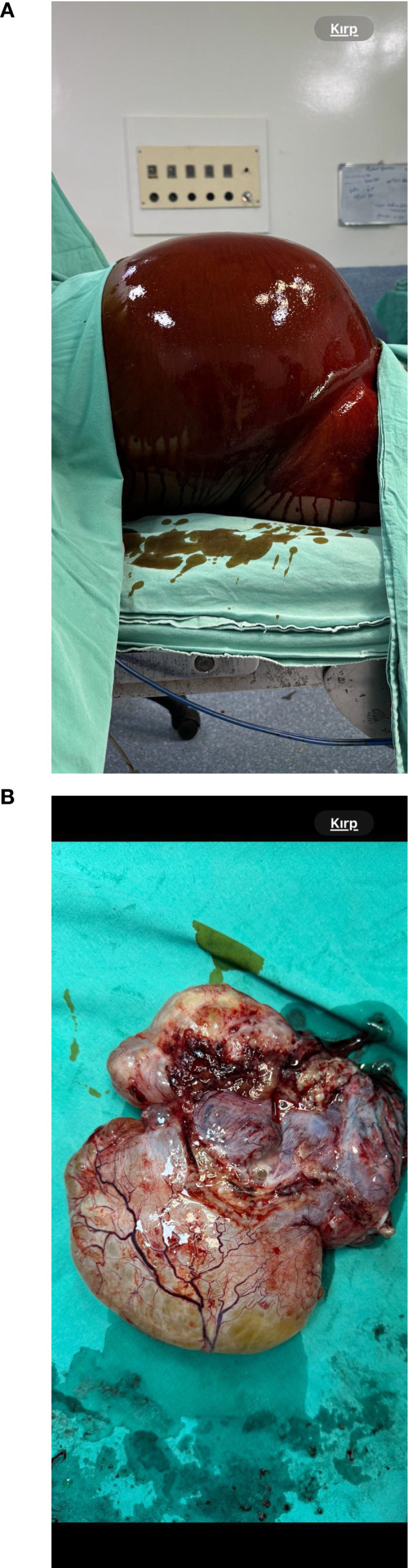 Figure 3