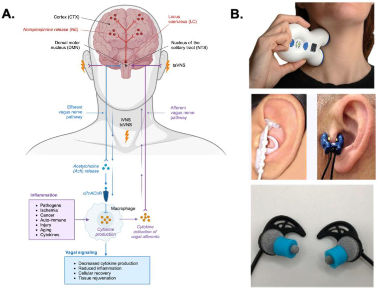 Figure 1
