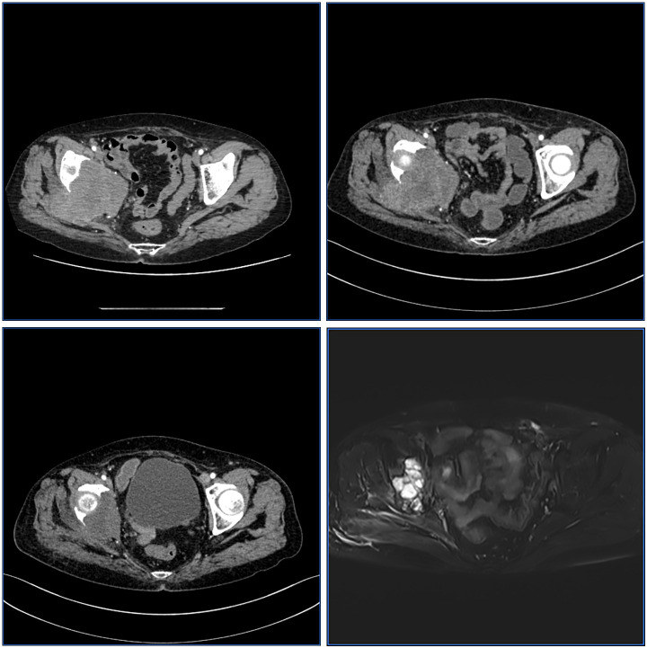Figure 1