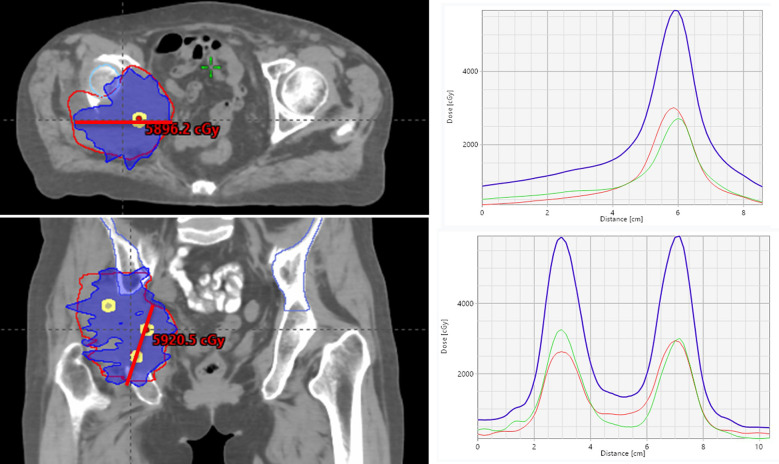Figure 3