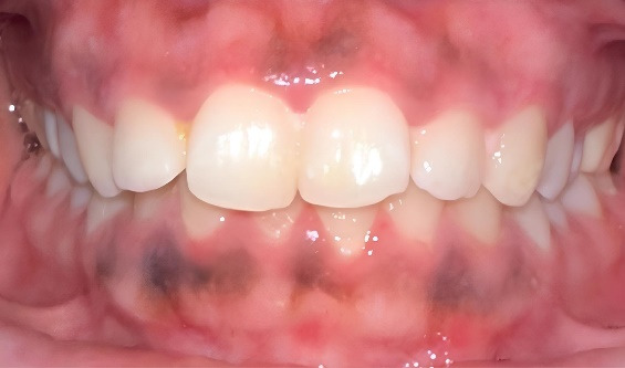 Figure 6