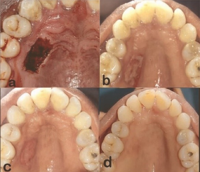 Figure 4