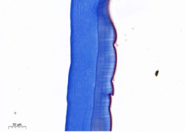 Figure 17