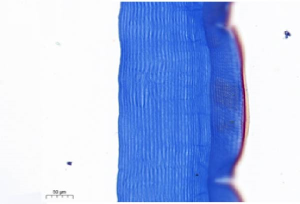 Figure 18