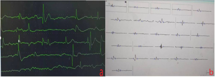 Figure 1