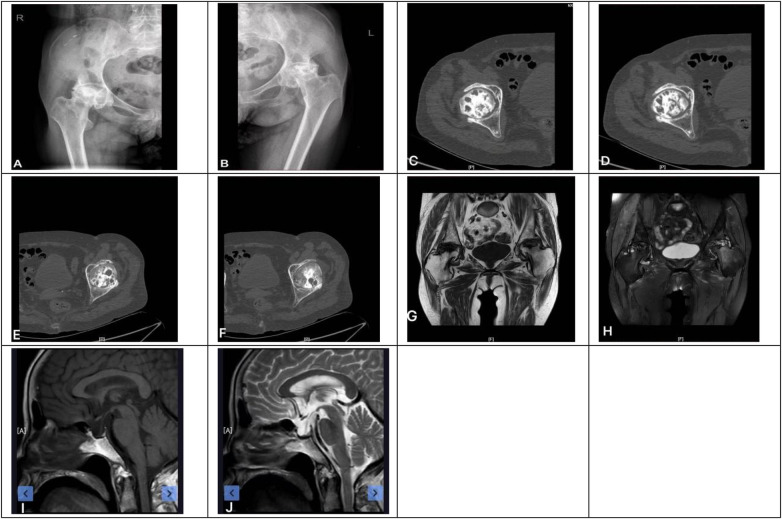 Figure 2
