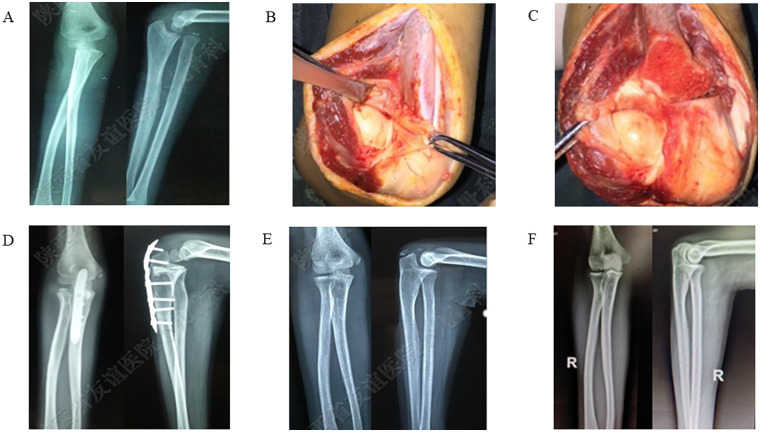 Figure 1