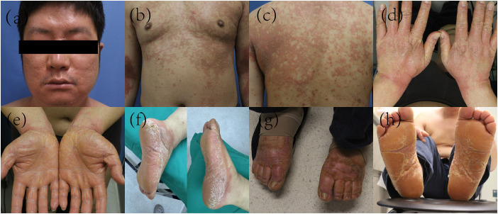 Figure 1